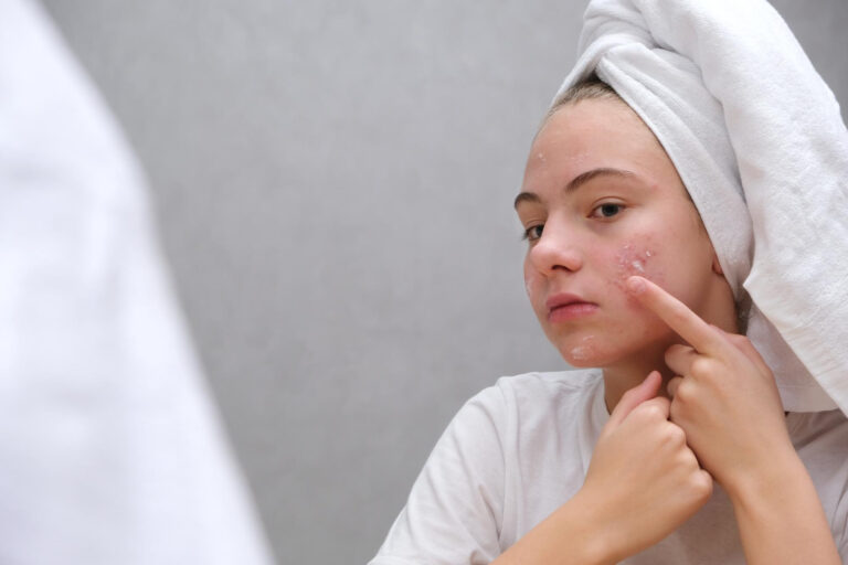 Comprehensive Guide to Effective Acne Treatment: Clear Skin Solutions