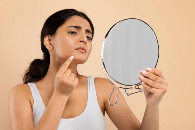 Conquer Acne with Comprehensive Acne Treatment Options