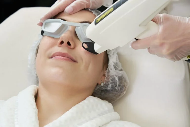 CO2 Laser Treatment Under Eyes