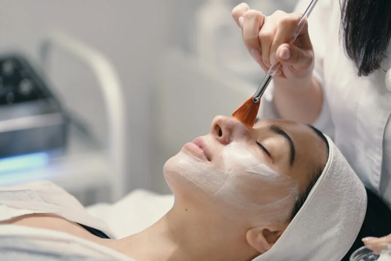 Chemical Peels for Acne