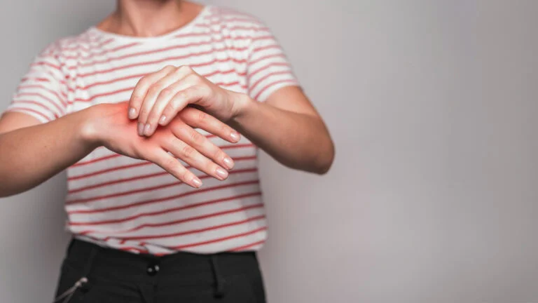Psoriatic Arthritis: When Skin and Joints Collide
