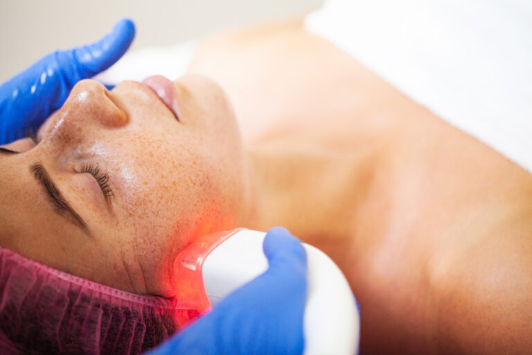 Laser Treatment for Brown Spots: What to Know (and What to Expect)