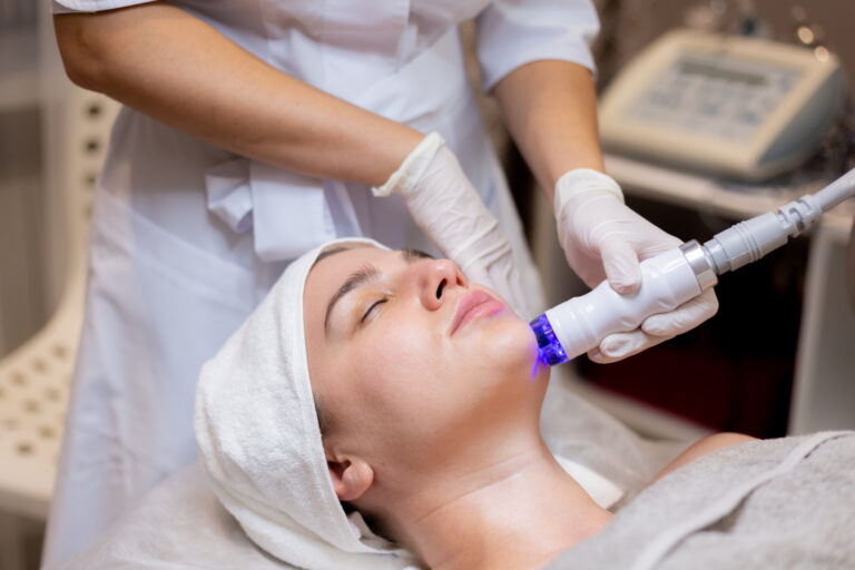 Vascular Laser Treatment for Acne: What You Need to Know