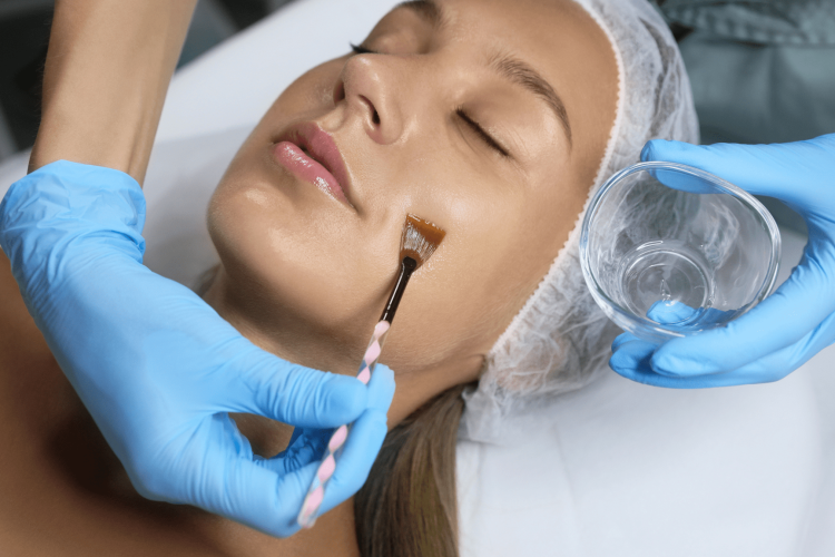 med spa chemical peel