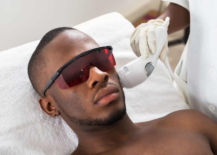 Men Cosmetic Laser