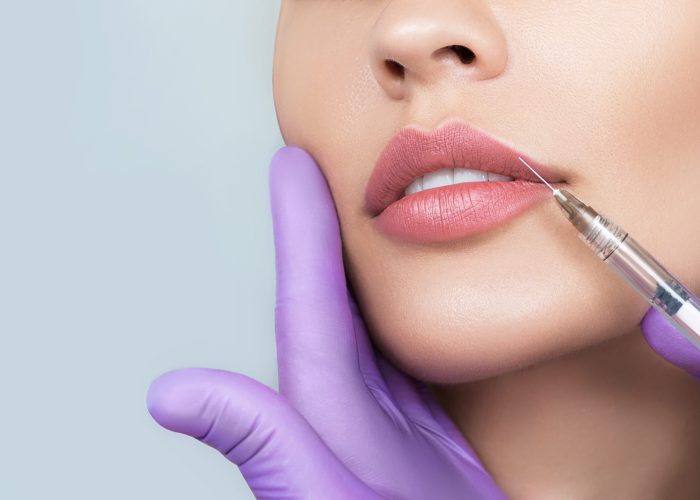 Cropped,Sensual,Female,Lips,,Procedure,Lip,Augmentation.,Syringe,Near,Womans